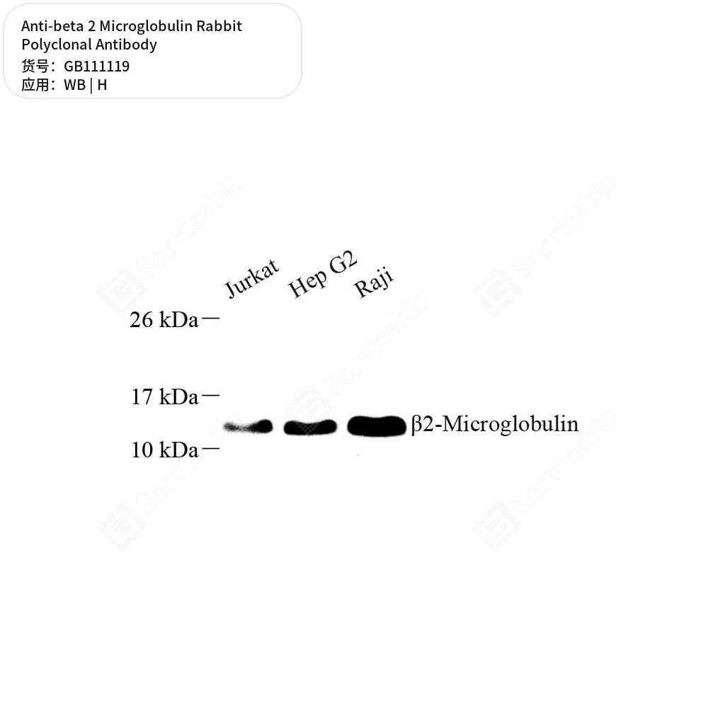Антитела первичные, поликлональные кролика к beta 2 Microglobulin человека, 100 мкл