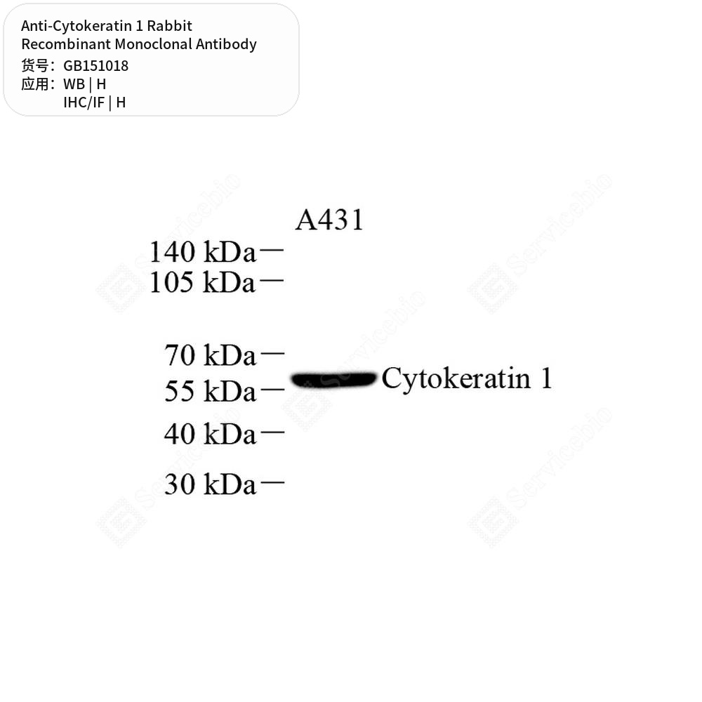 Антитела первичные, моноклональные кролика к Cytokeratin 1 человека, 50 мкл
