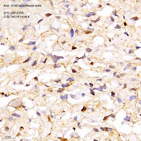 Антитела первичные, моноклональные, S100 beta, 100 мкл