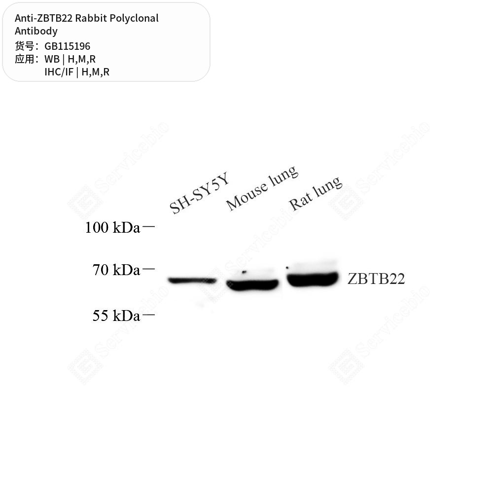 Антитела первичные, поликлональные кролика к ZBTB22 крысы, мыши, человека, 50 мкл