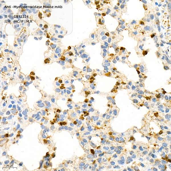 Антитела первичные, моноклональные, Myeloperoxidase, 100 мкл