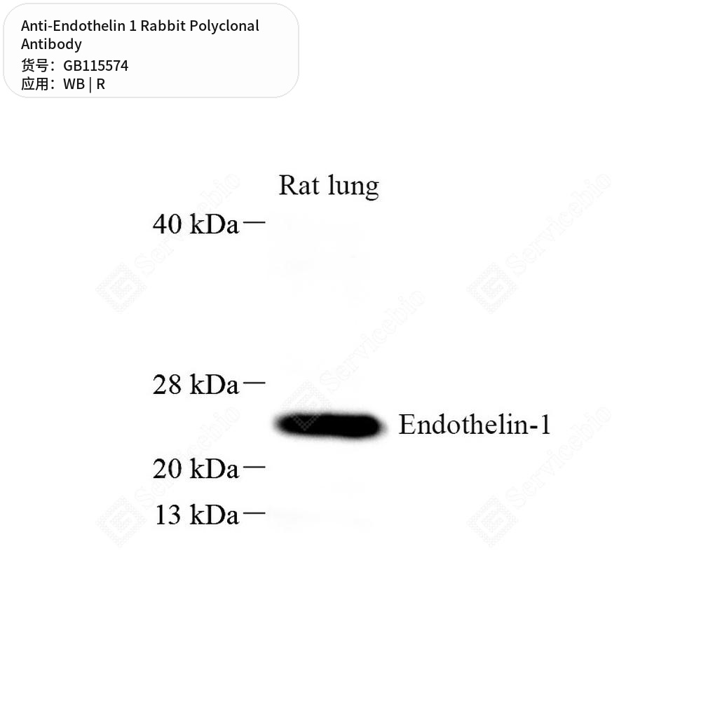 Антитела первичные, поликлональные кролика к Endothelin 1 крысы, 50 мкл
