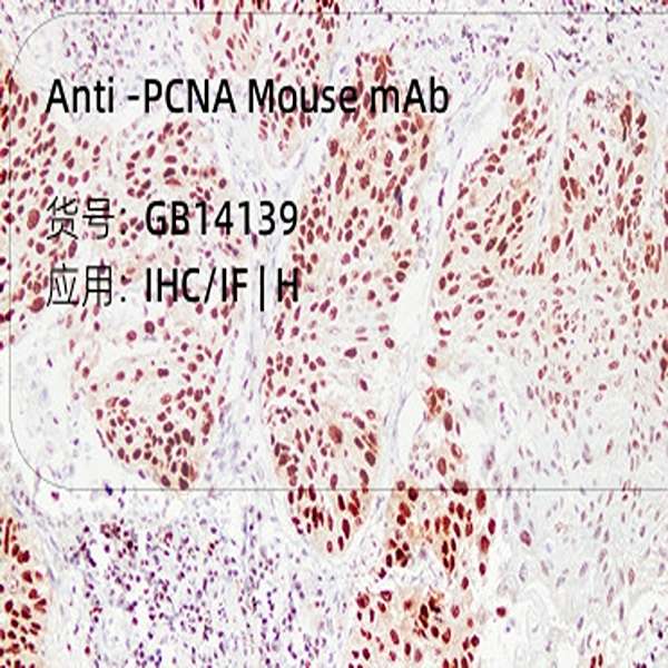 Антитела первичные, моноклональные, ProlifeRating Cell Nuclear Antigen (PCNA), 50 мкл