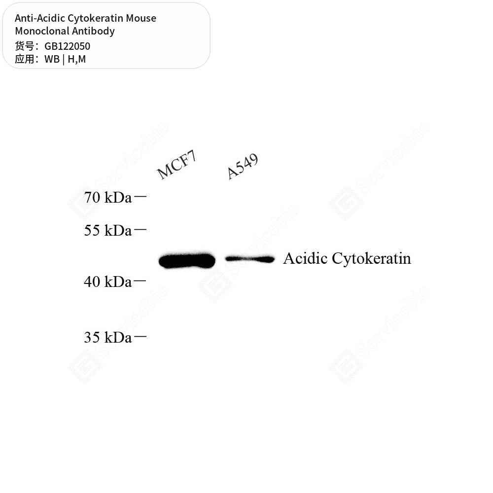 Антитела первичные, моноклональные мыши к Acidic Cytokeratin мыши, человека, 50 мкл