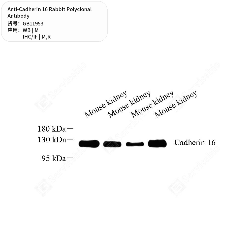 Антитела первичные, поликлональные кролика к Cadherin 16 крысы, мыши, 50 мкл