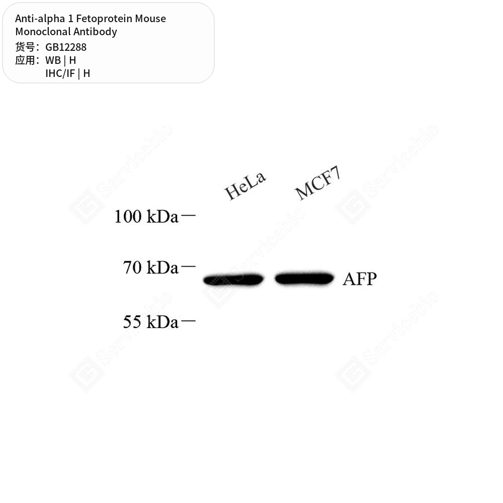 Антитела первичные, моноклональные мыши к alpha 1 Fetoprotein человека, 100 мкл