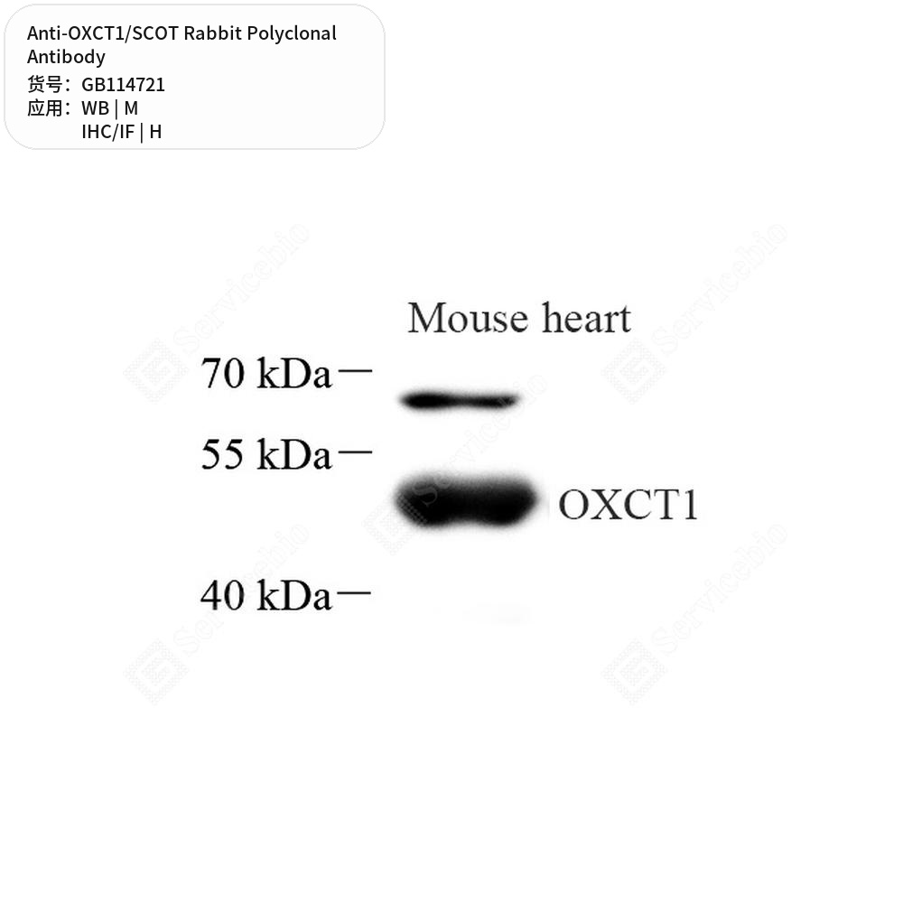 Антитела первичные, поликлональные кролика к OXCT1/SCOT мыши, человека, 50 мкл