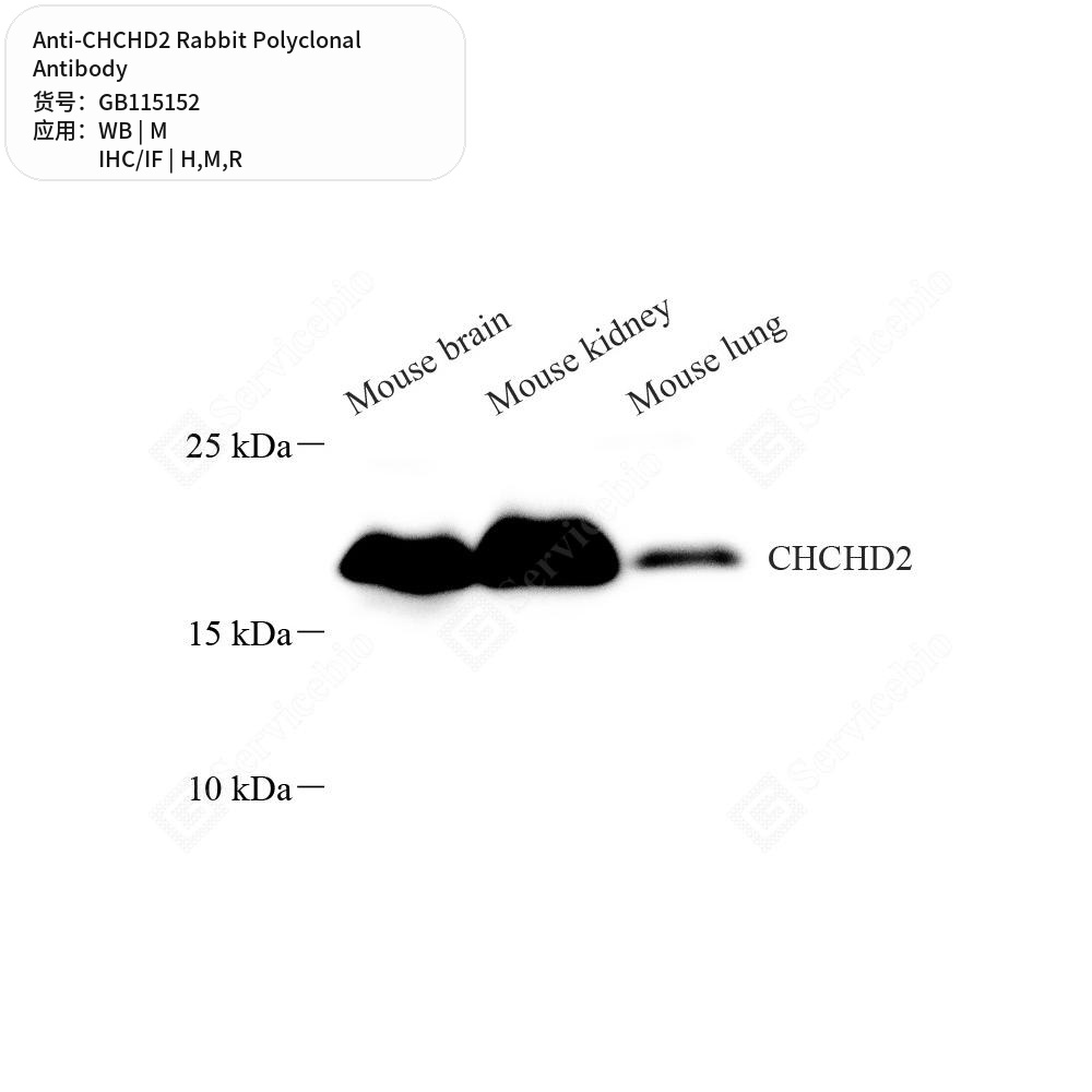 Антитела первичные, поликлональные кролика к CHCHD2 крысы, мыши, человека, 50 мкл