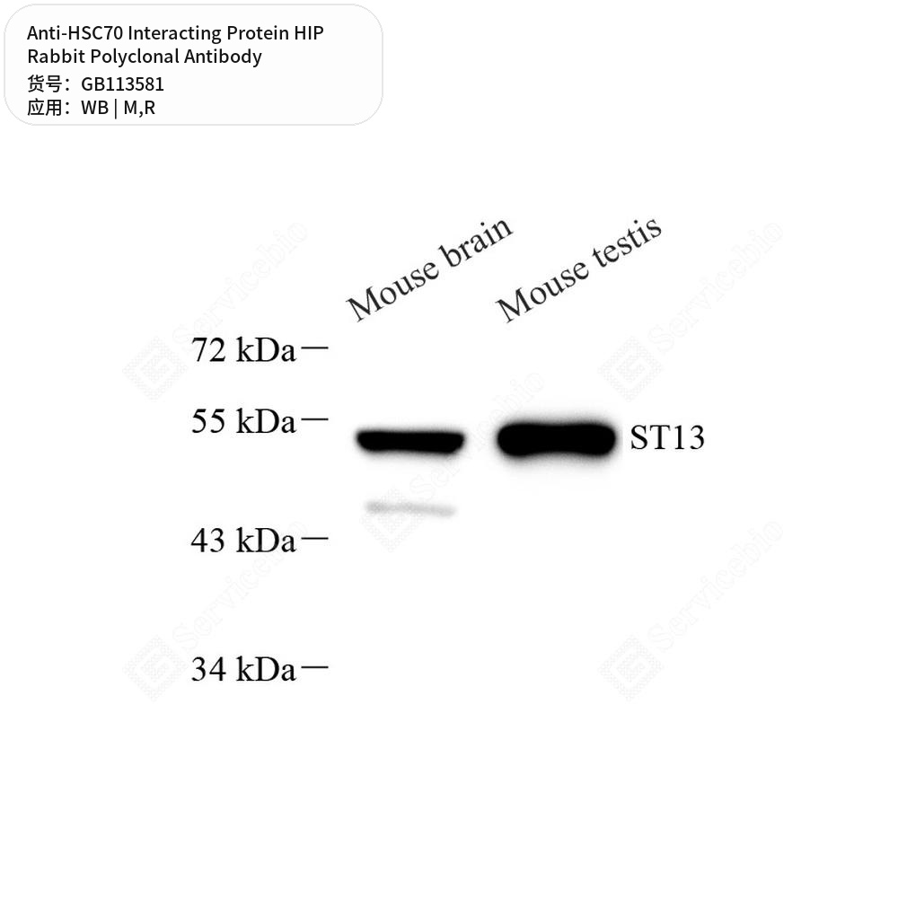 Антитела первичные, поликлональные кролика к HSC70 Interacting Protein HIP крысы, мыши, 50 мкл