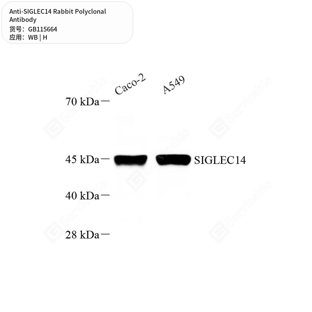 Антитела первичные, поликлональные кролика к SIGLEC14 человека, 50 мкл