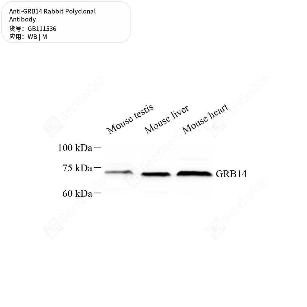 Антитела первичные, поликлональные кролика к GRB14 мыши, 100 мкл
