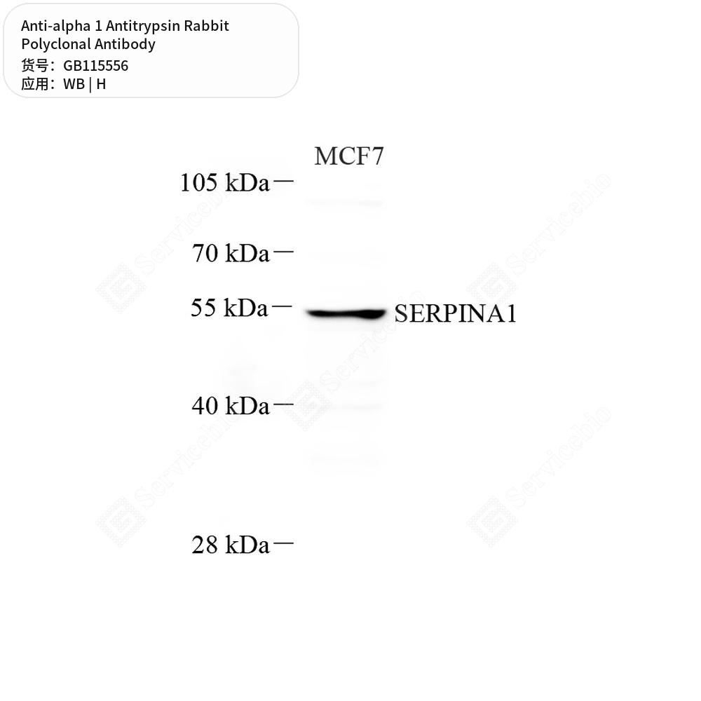 Антитела первичные, поликлональные кролика к alpha 1 Antitrypsin человека, 50 мкл