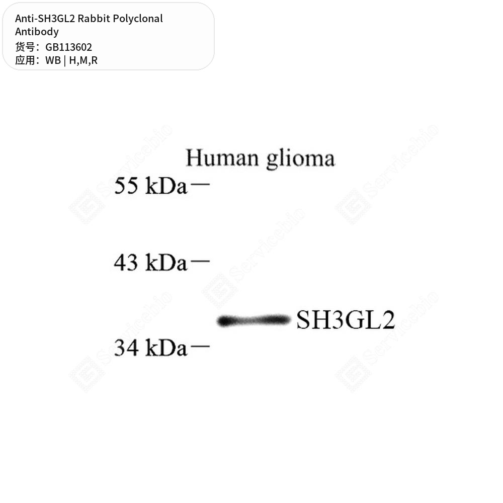 Антитела первичные, поликлональные кролика к SH3GL2 крысы, мыши, человека, 50 мкл