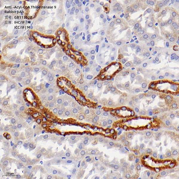 Антитела первичные, поликлональные, Acyl-CoA Thioesterase 9, 100 мкл