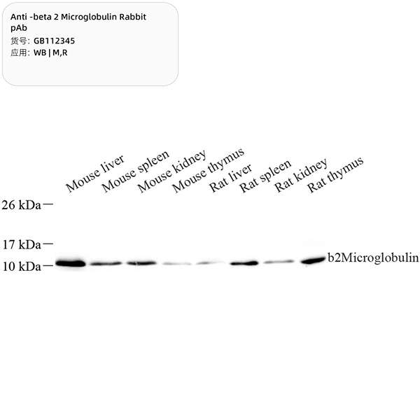 Антитела первичные, поликлональные, beta 2 Microglobulin, 100 мкл