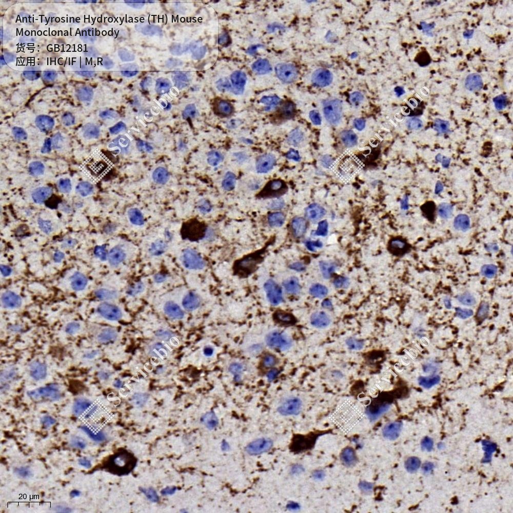 Антитела первичные, моноклональные мыши к Tyrosine Hydroxylase (TH) крысы, мыши, 50 мкл