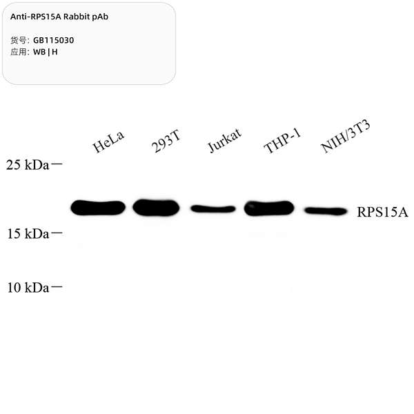 Антитела первичные, поликлональные, RPS15A, 100 мкл