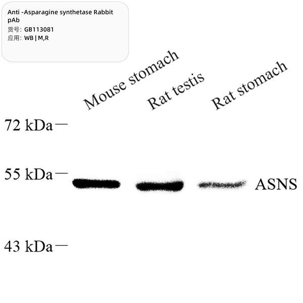Антитела первичные, поликлональные, Asparagine synthetase, 100 мкл
