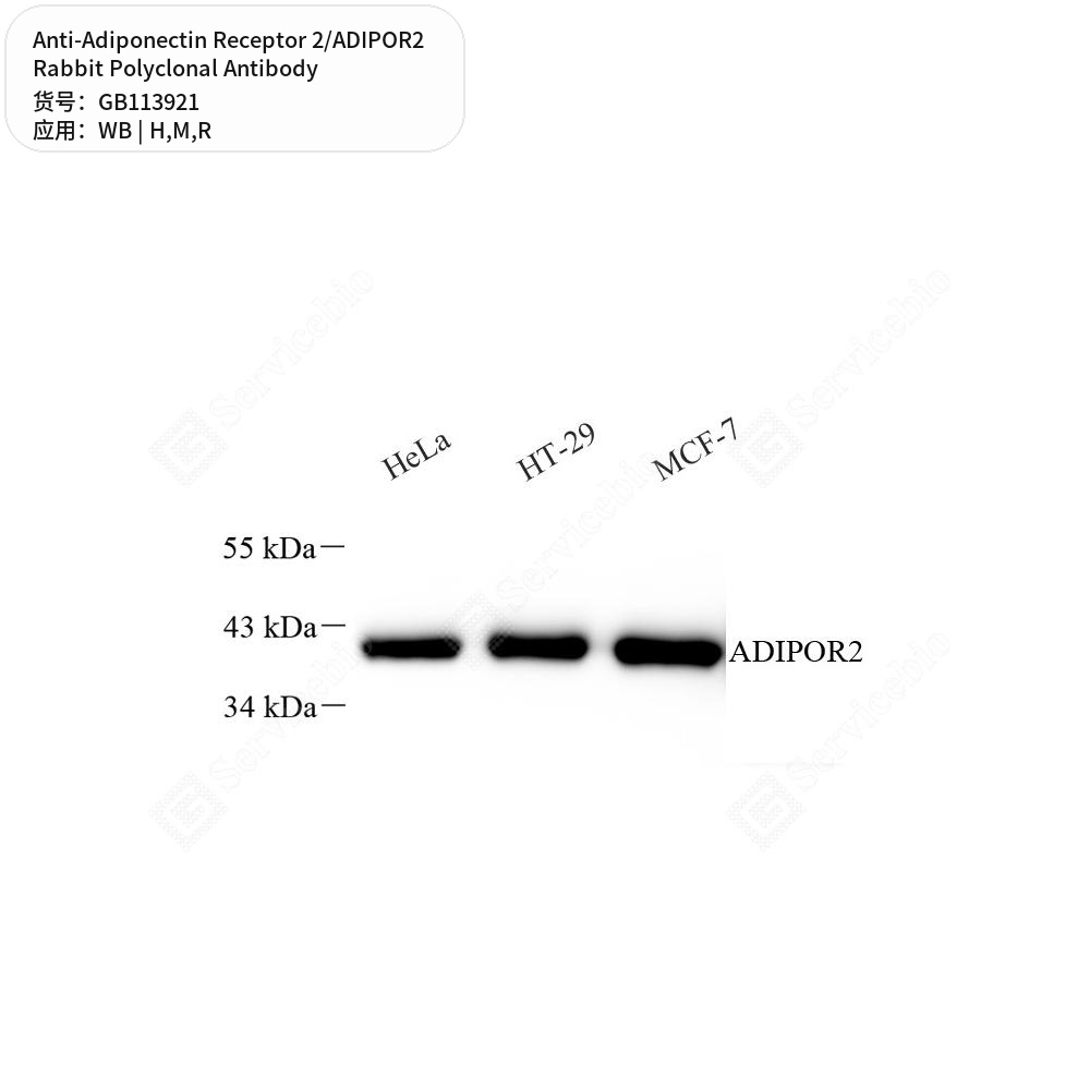 Антитела первичные, поликл. кролика к Adiponectin Receptor 2/ADIPOR2 крысы, мыши, человека, 50 мкл