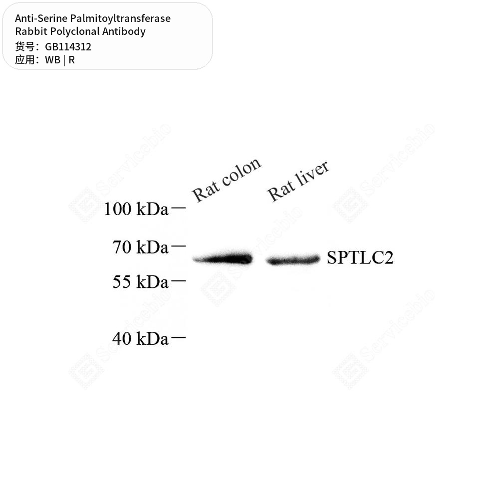 Антитела первичные, поликлональные кролика к Serine Palmitoyltransferase крысы, 50 мкл