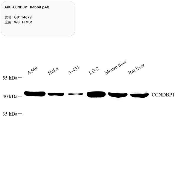 Антитела первичные, поликлональные, CCNDBP1, 100 мкл