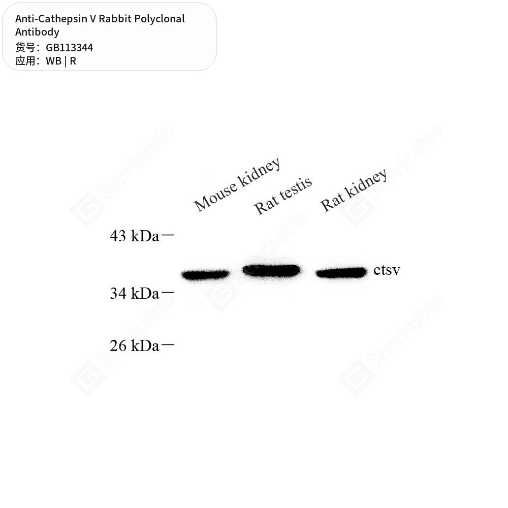 Антитела первичные, поликлональные кролика к Cathepsin V крысы, 50 мкл