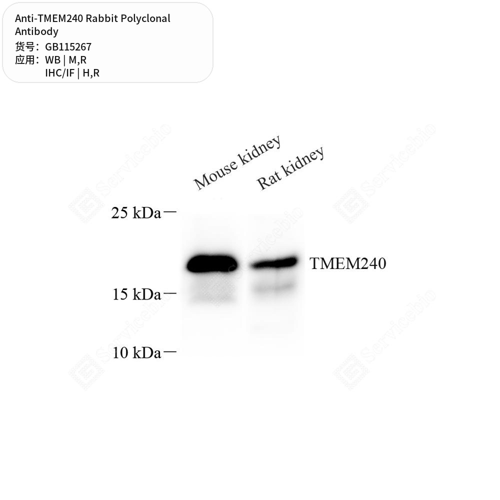 Антитела первичные, поликлональные кролика к TMEM240 крысы, мыши, человека, 50 мкл