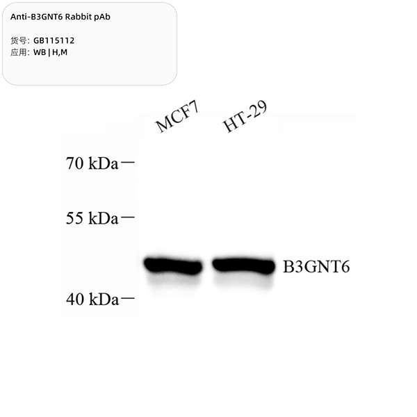 Антитела первичные, поликлональные, B3GNT6, 100 мкл