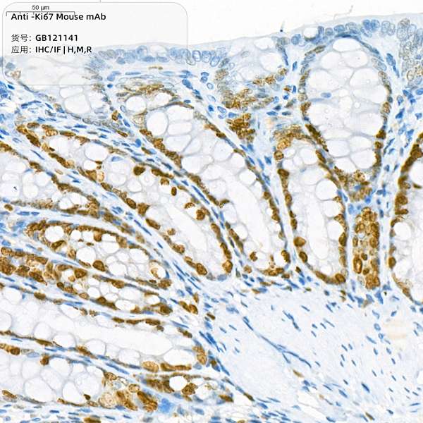 Антитела первичные, моноклональные Ki67, 100 мкл