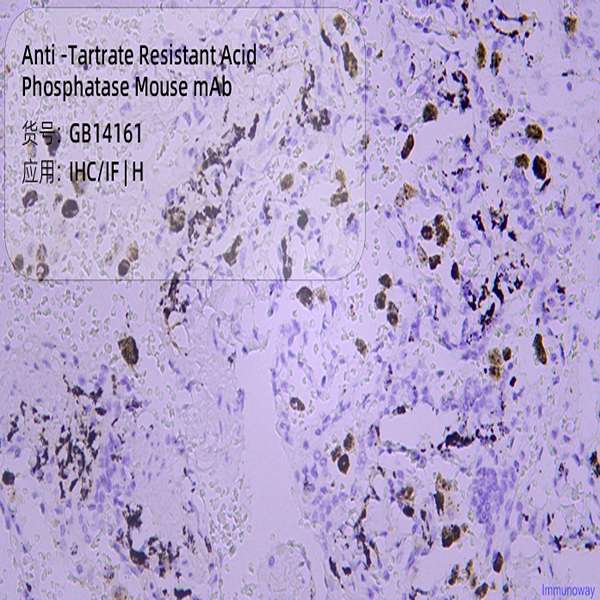 Антитела первичные, моноклональные, Tartrate Resistant Acid Phosphatase, 50 мкл