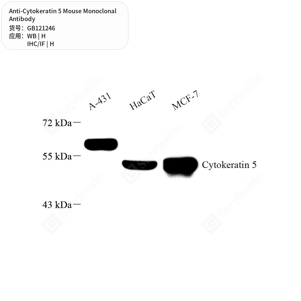 Антитела первичные, моноклональные мыши к Cytokeratin 5 человека, 50 мкл