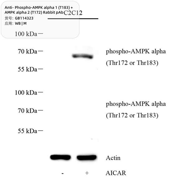 Антитела первичные, поликлональные, Phospho-AMPK alpha 1 (T183) + AMPK alpha 2 (T172), 100 мкл