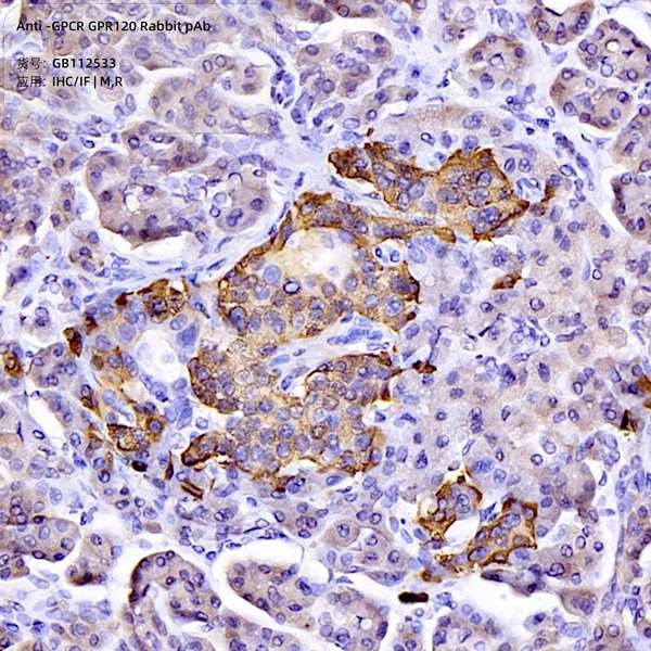 Антитела первичные, поликлональные, GPCR GPR120, 100 мкл