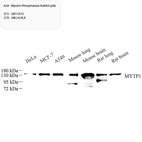Антитела первичные, поликлональные, Myosin Phosphatase, 100 мкл