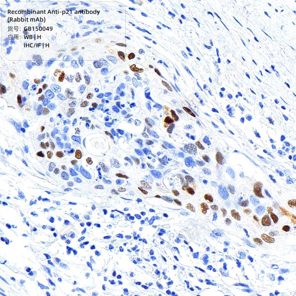 Антитела первичные, моноклональные P21, рекомбинантные, 100 мкл