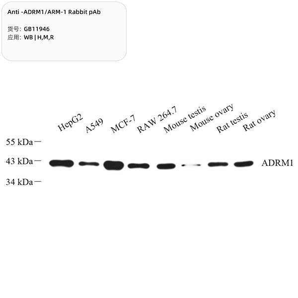 Антитела первичные, поликлональные, ADRM1/ARM-1, 100 мкл