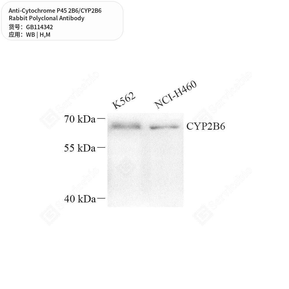 Антитела первичные, поликлональные кролика к Cytochrome P45 2B6/CYP2B6 мыши, человека, 50 мкл