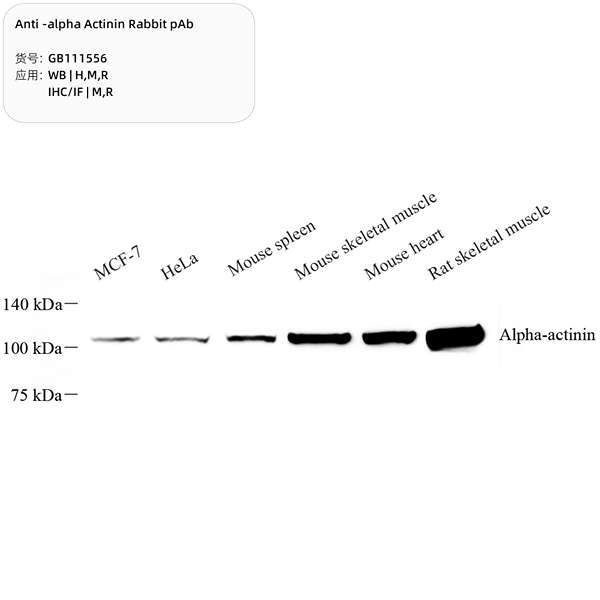 Антитела первичные, поликлональные, alpha Actinin, 100 мкл