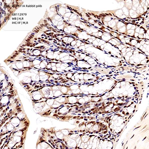 Антитела первичные, поликлональные, ZC3H11A, 100 мкл