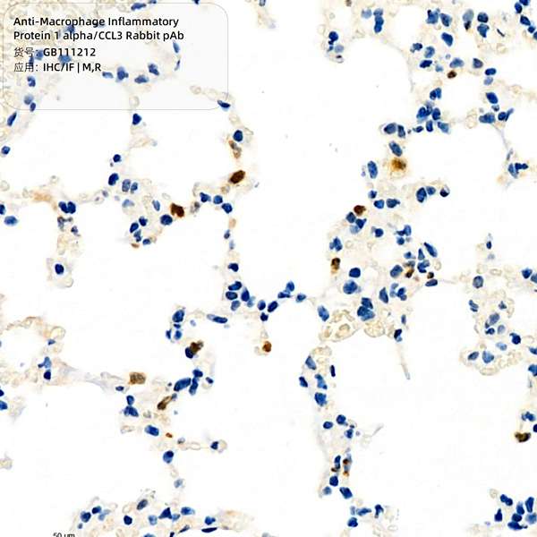 Антитела первичные, поликлональные, Macrophage Inflammatory Protein 1 alpha/CCL3, 100 мкл
