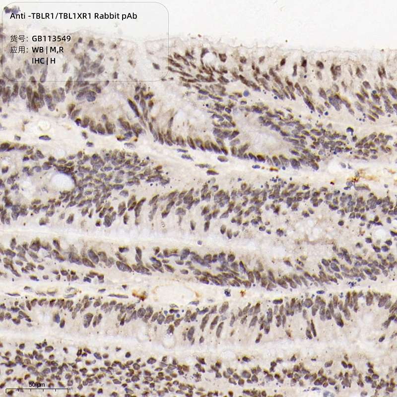Антитела первичные, поликлональные, TBLR1/TBL1XR1, 100 мкл