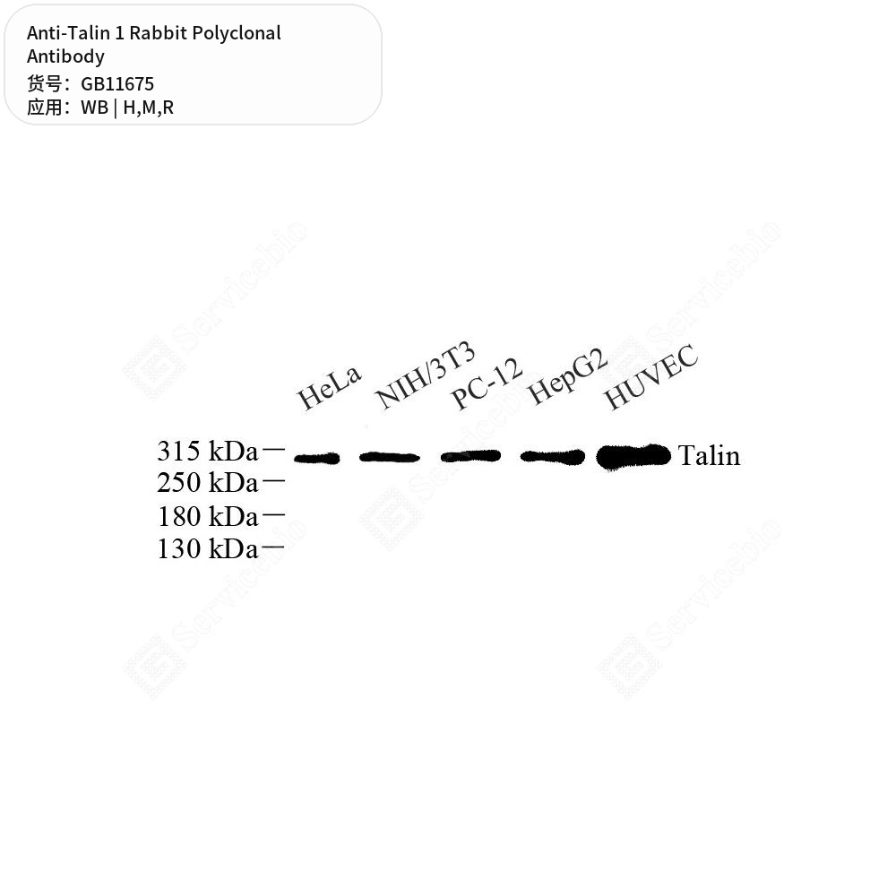 Антитела первичные, поликлональные кролика к Talin 1 крысы, мыши, человека, 50 мкл