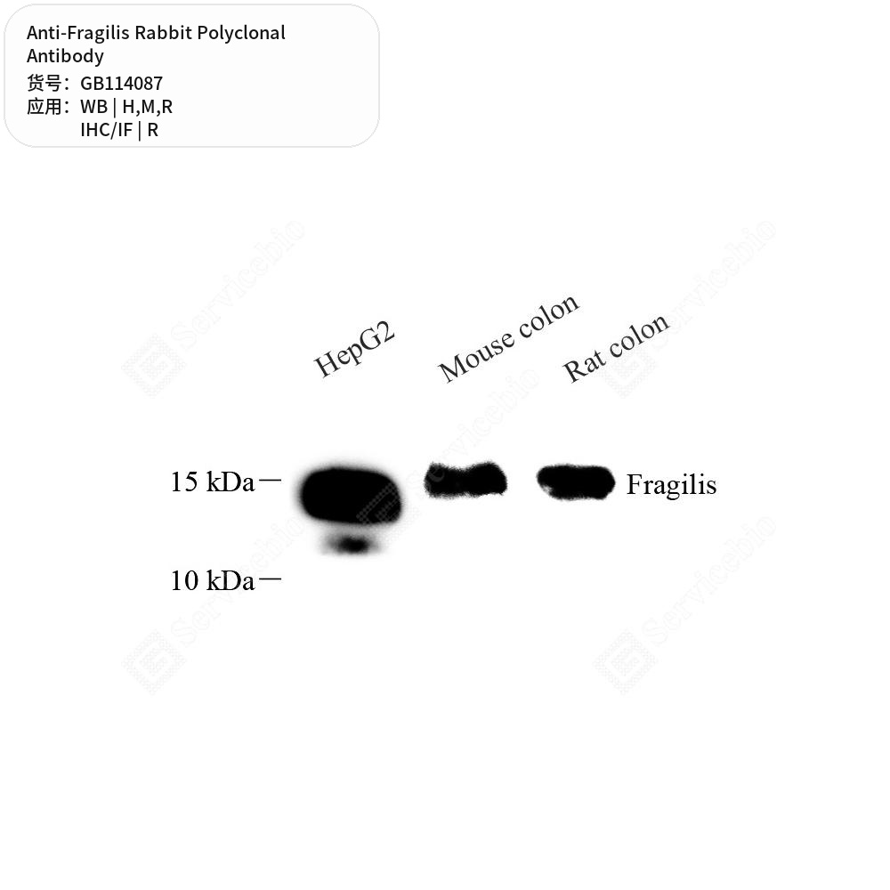 Антитела первичные, поликлональные кролика к Fragilis крысы, мыши, человека, 50 мкл