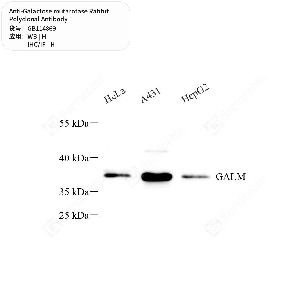 Антитела первичные, поликлональные кролика к Galactose mutarotase человека, 50 мкл