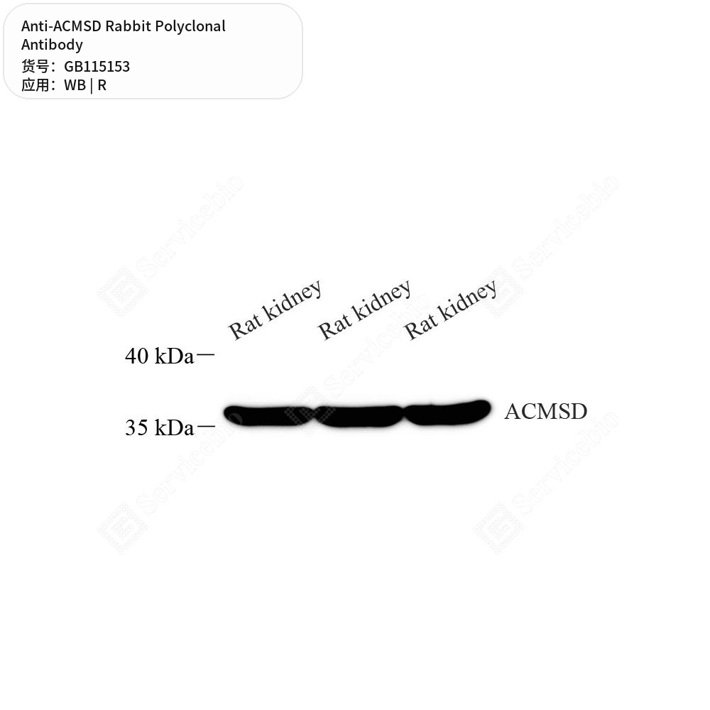 Антитела первичные, поликлональные кролика к ACMSD крысы, 50 мкл