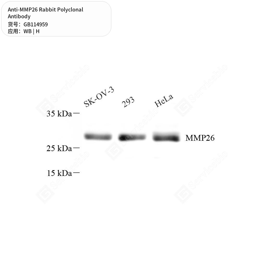 Антитела первичные, поликлональные кролика к MMP26 человека, 50 мкл