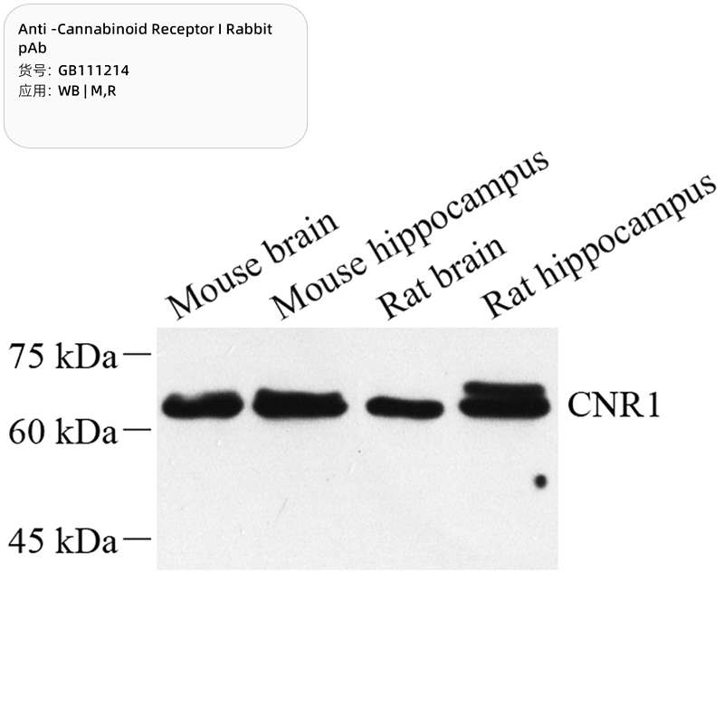 Антитела первичные, поликлональные, Cannabinoid Receptor I, 100 мкл