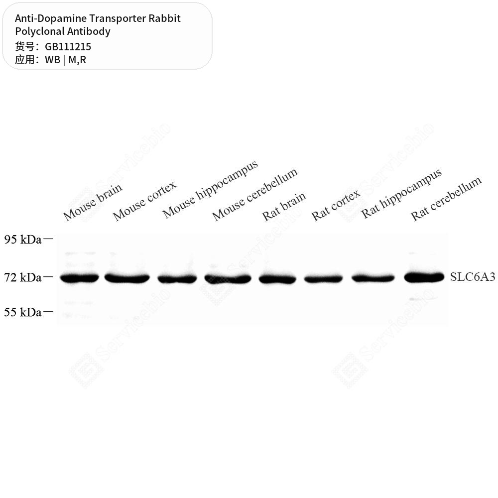 Антитела первичные, поликлональные кролика к Dopamine Transporter крысы, мыши, 100 мкл