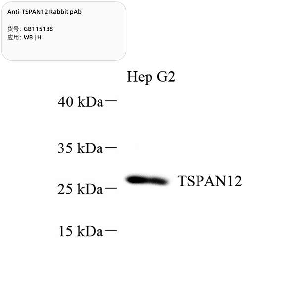 Антитела первичные, поликлональные, TSPAN12, 100 мкл