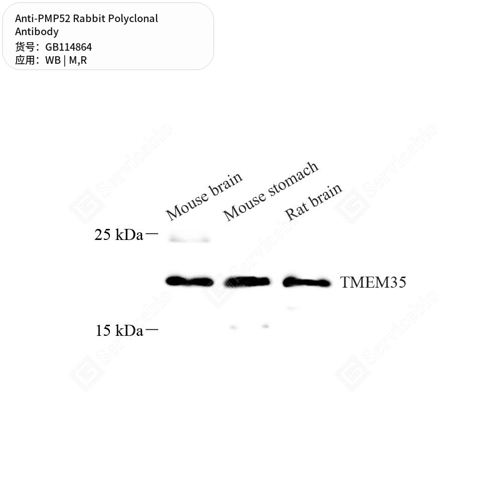 Антитела первичные, поликлональные кролика к PMP52 крысы, мыши, 50 мкл